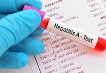 Hepatitis A: se confirmaron 32 casos nuevos y el país entró en zona de alerta sanitaria