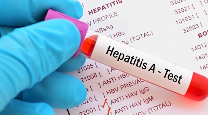 Hepatitis A: se confirmaron 32 casos nuevos y el país entró en zona de alerta sanitaria